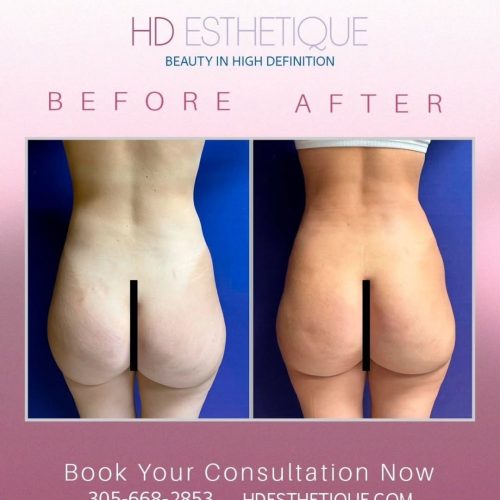 Real recovery. Real results. This powerful before & after shows the outcome of a successful bio